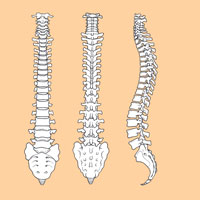 Anterior Cervical  Discectomy