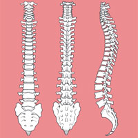 Posterior Lumbar Decompression for Spinal Stenosis