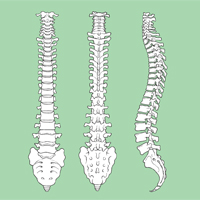 Cervical Myelopathy