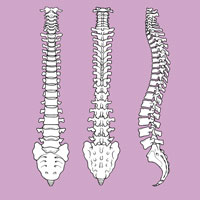 Lumbar Disc Protrusions – Surgical Options