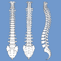 Lumbar FacetJoint Syndrome– Injection Treatment