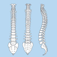 Lumbar Nerve  Root Block