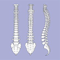 Lumbar Spondylolysis